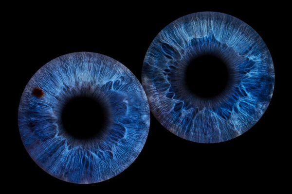 Gutschein für 2 x Irisfotografie ( 2 Iriden )