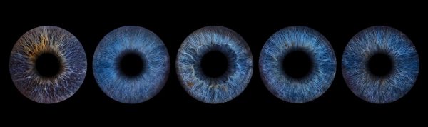 Gutschein für 5 x Irisfotografie (5 Iriden) – Bild 2