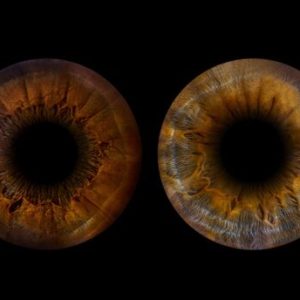 Gutschein für 4 x Irisfotografie (4 Iriden)